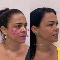 22B20908-E2FE-4E3A-B52B-971246BE04AD (1)